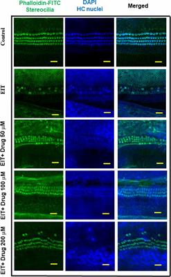 Evaluating the Efficacy of Taurodeoxycholic Acid in Providing Otoprotection Using an in vitro Model of Electrode Insertion Trauma